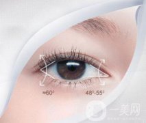 開內(nèi)外眼角手術(shù)會有疤痕嗎？