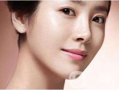 有頸紋怎么辦 去除頸紋的辦法