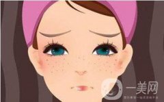 c6激光祛斑多少錢 c6激光祛斑價格