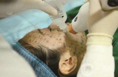 thermage熱瑪吉緊膚一次多少錢？