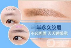 繡眉需要多少錢 繡眉的價(jià)格是多少