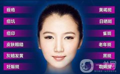 彩光嫩膚祛斑多少錢 彩光嫩膚祛斑價(jià)格介紹