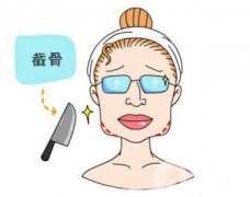 下頜角截骨手術(shù)頭套戴多久 恢復(fù)期要多久？