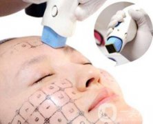 熱瑪吉除皺價格是多少錢？