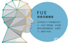 什么是fue植發(fā)，fue植發(fā)技術(shù)果怎么樣？