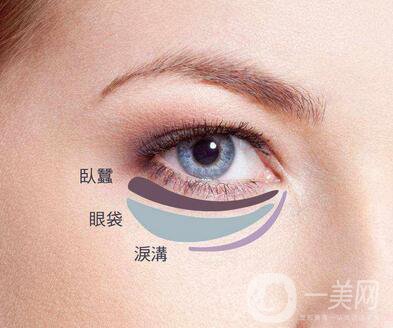 吸脂去下眼瞼眼袋怎么樣？