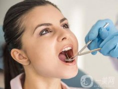 成都種植牙信息介紹？