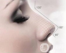 膨體隆鼻缺點有哪些？