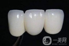 貴金屬烤瓷牙的危害有哪些？