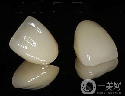 貴金屬烤瓷牙的危害有哪些？