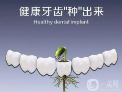 昆山種植牙多少錢 費(fèi)用詳情一覽