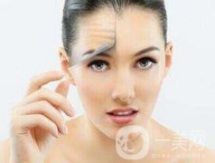 抬頭紋太重怎么辦？如何去抬頭紋？