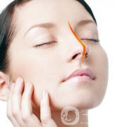 硅膠墊鼻梁多久生包膜？如何避免隆鼻后遺癥？