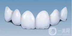 貴金屬烤瓷牙的種類有哪些 分別有那些優(yōu)點(diǎn)