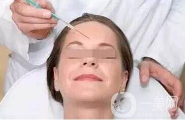 去除抬頭紋