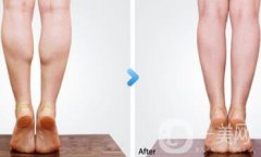 南京注射注射瘦臉注射瘦腿多少錢