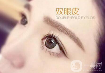 上海割雙眼皮好嗎?割雙眼皮多久恢復?