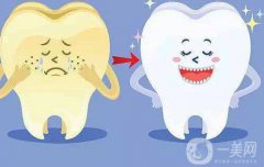 *潔牙多少錢一次?價格主要取決于那些方面?