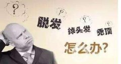 脫發(fā)怎么辦？鄭州植發(fā)醫(yī)院信息介紹？