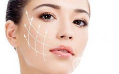 *除皺*嗎？可以維持多久的時(shí)間？