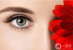 杭州割雙眼皮大概需要多少錢