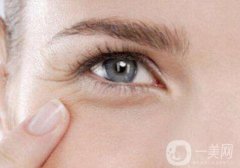 怎么除魚尾紋？有哪些方法？