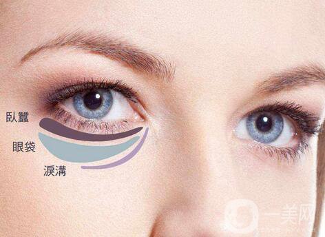 內(nèi)切祛眼袋多久恢復(fù)？