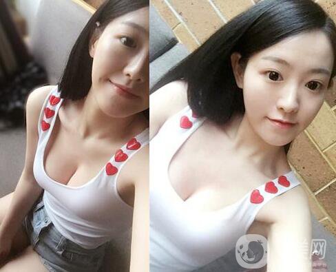 假體隆胸有什么危害？