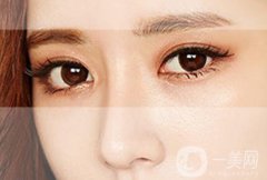 做韓式*雙眼皮術(shù)優(yōu)點(diǎn)有哪些