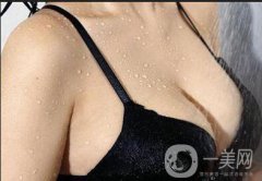 假體隆胸手術(shù)做完之后恢復(fù)期要多久時(shí)間？