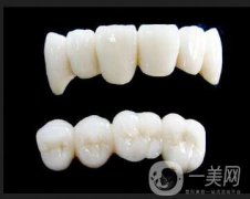 深圳做烤瓷牙一般要多少錢