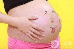 有妊娠紋怎么辦？什么方法**？