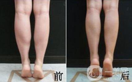 *的副作用有哪些？