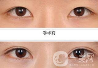*都包含哪些項目？*整形多少錢