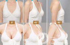 自體隆胸后多久可以上班？術(shù)后有哪些注意事項