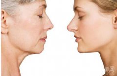 什么是小切口拉皮除皺術(shù)？適用人群有哪些？