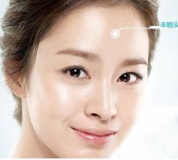 墊額頭手術(shù)有哪些注意事項?