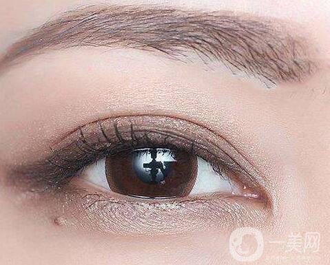 割雙眼皮術(shù)后注意事項有哪些？