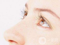 雙眼皮增生是什么樣子？