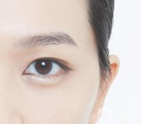 什么人適合開眼角？開眼角適宜人群有哪些？