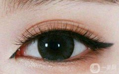 開眼角失敗怎么辦呢?開眼角手術(shù)失敗了怎么補救?