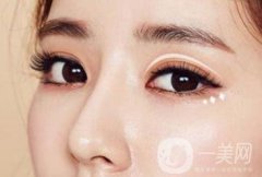 下眼下至術(shù)前準(zhǔn)備具體有哪些