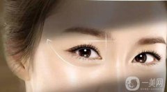 去韓國開眼角需要準(zhǔn)備多少錢?