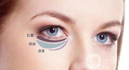 內(nèi)切祛眼袋術(shù)后護(hù)理主要有哪幾點？