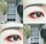 埋線雙眼皮要拆線嗎？如何護理？