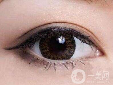 埋線雙眼皮要拆線嗎？如何護(hù)理？