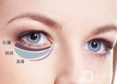 內(nèi)切眼袋真實恢復(fù)過程，術(shù)后注意事項