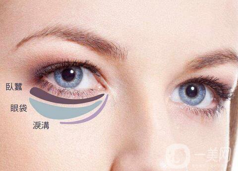 內(nèi)切眼袋真實(shí)恢復(fù)過程，術(shù)后注意事項(xiàng)