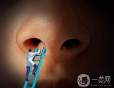 怎么縮小鼻翼？縮小鼻翼術(shù)后護(hù)理