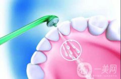 超聲波潔牙果 注意事項(xiàng)主要有哪些